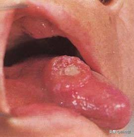 最实用的舌诊图六大舌象,舌诊深入学习书