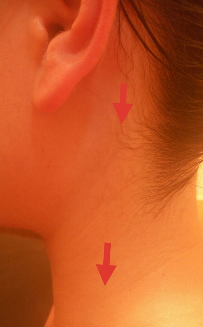 宝宝扁桃体肿大不愿意喝奶,宝宝扁桃体一直发炎不好怎么回事