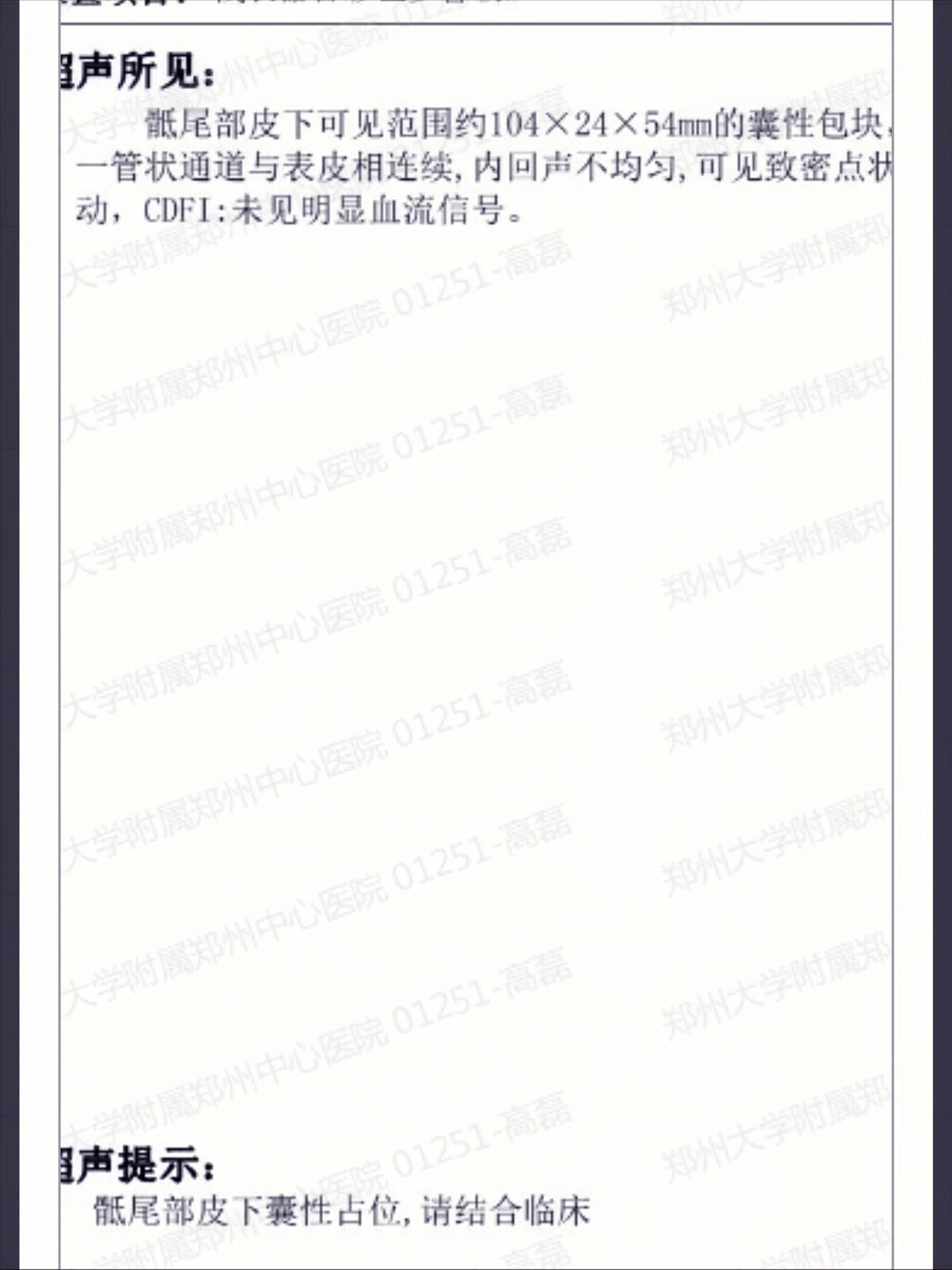 让我虚惊一场的骶前巨大囊肿