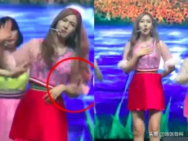 习惯性脱臼患者,习惯性脱臼一动就掉