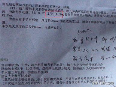 孕中期脐动脉血流缺失,26周胎儿出现脐血流缺失怎么办