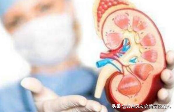 痛风患肾结石的概率高吗,痛风患者患肾结石的几率高吗