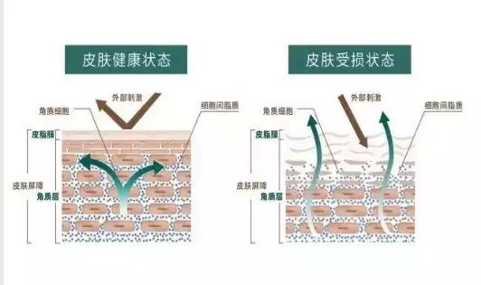 抗老修复护肤产品,修复类的护肤品有哪些品牌