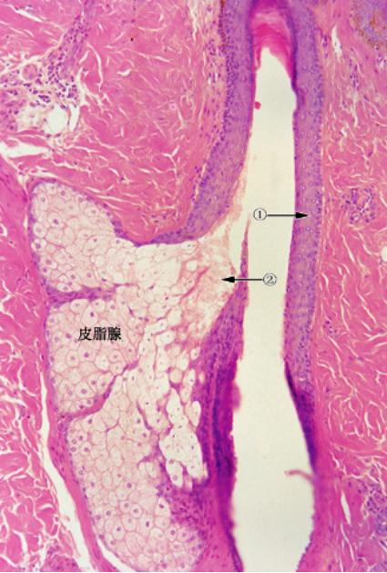 宝宝头垢不清理会有什么后果,婴儿头垢用手抠了咋办
