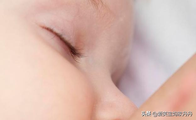 婴儿眼屎多怎么做局部护理,新生儿眼屎多如何护理
