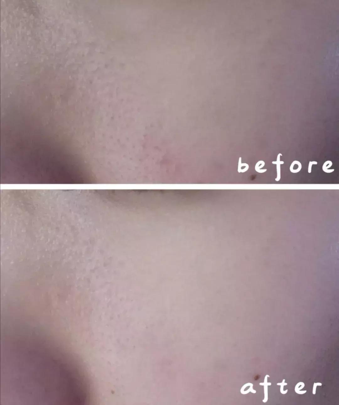 日常这些护肤误区千万不要踩,十大护肤烂脸成分