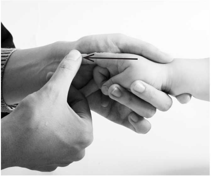 儿童扁桃体肥大最简单的偏方,小儿扁桃体肥大反复发炎怎么办