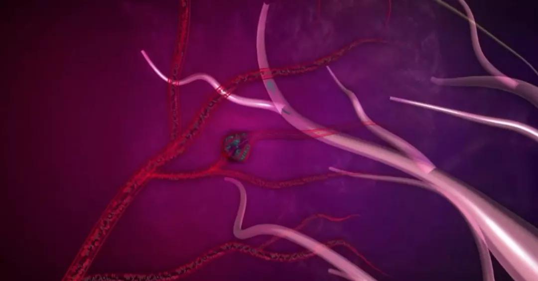 女性做两癌筛查前可以吃饭喝水吗,女性两癌筛查后可以正常工作吗