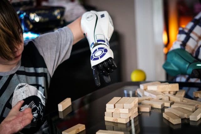 没有双臂的美国男孩获得假肢,失去双臂男孩考上剑桥大学