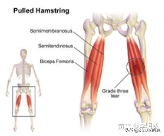 x型腿该怎么解决呢,x型腿怎么治