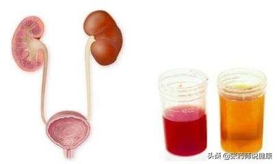 老人尿尿有血红色是怎么回事,2岁半孩子尿尿有红色沉淀物