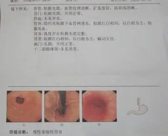 胃胀2天不见好转,胃胀吃了两个月的药不见好