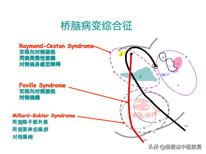 中枢神经系统断层解剖讲解,中枢神经3d解剖动画