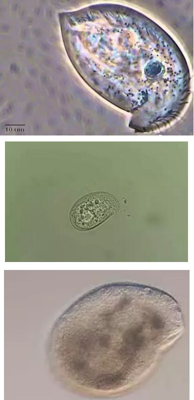 水产镜检虫图片,水产养殖常见虫类图