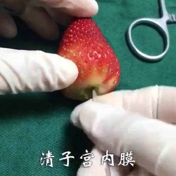 人流之后对子宫的伤害,人流对子宫有哪些危害