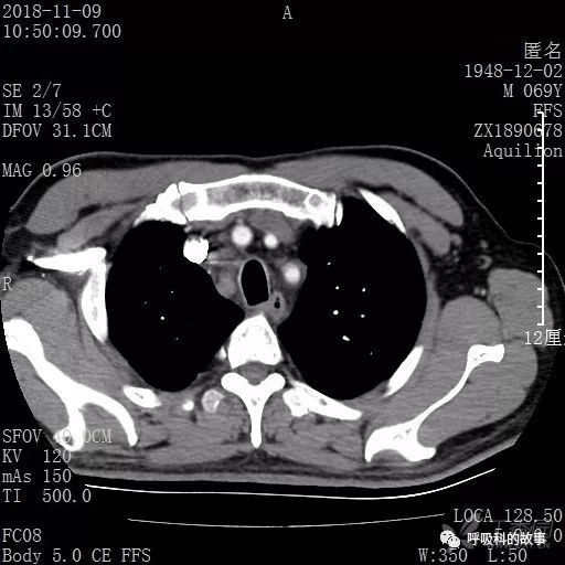 怎么应用统计学做调查,统计学方法可以解决的主要问题