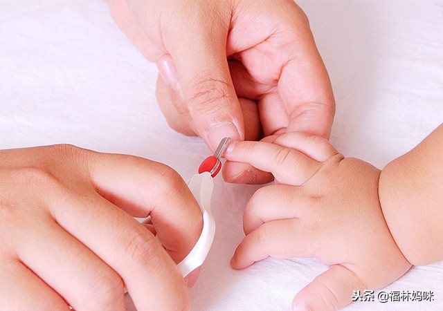 宝宝得了水痘用吃药吗,宝宝长水痘一定要注意什么