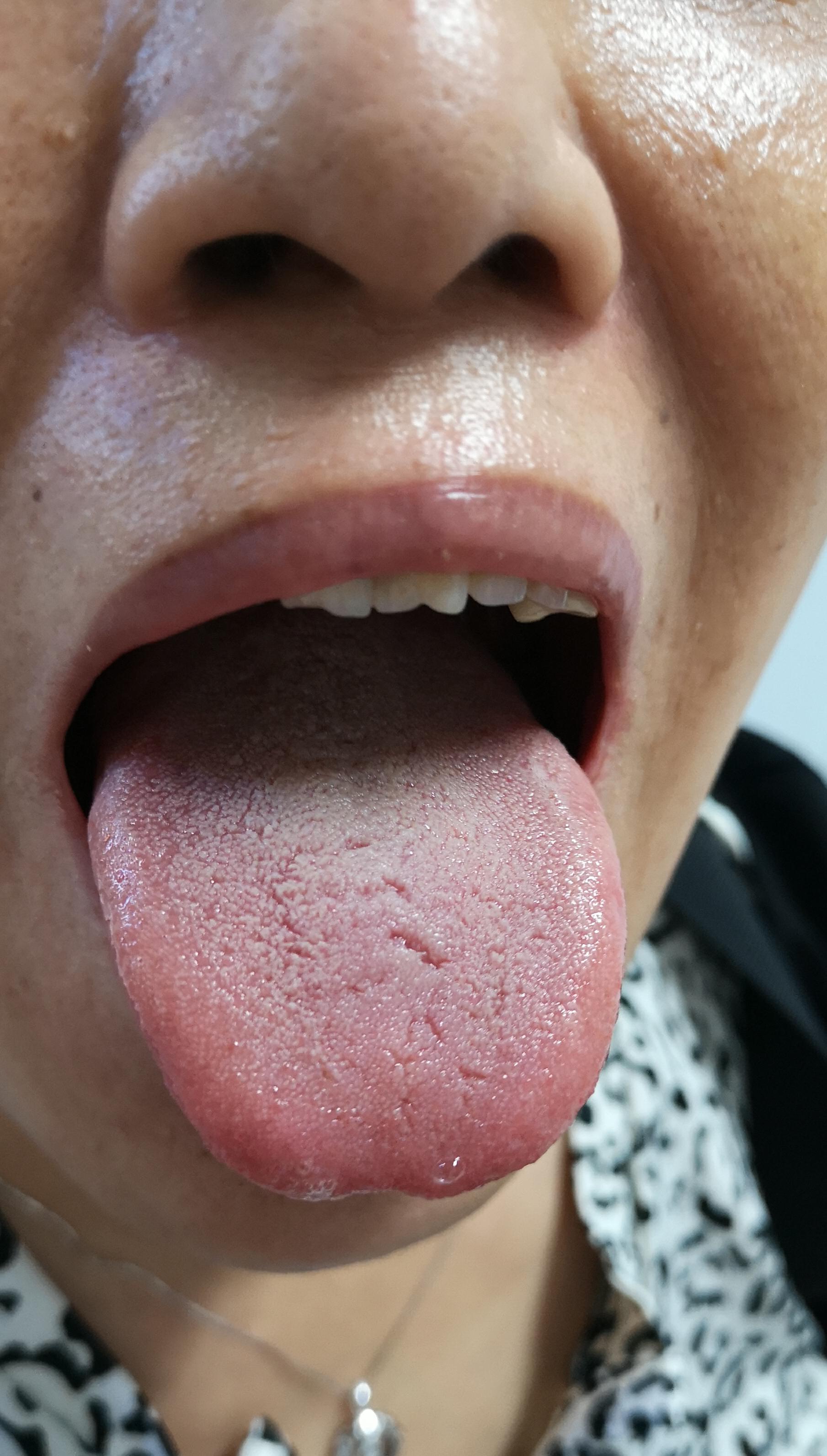 某女士便秘20年，服药1周便秘好转，特此录制视频表示感谢