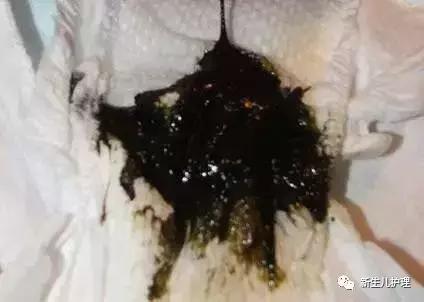 新手爸妈｜奶瓣、绿便、腹泻、便秘……宝宝各种便便真图全解必备