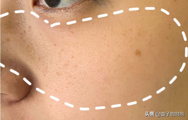 祛斑一个月了怎么还没有好,最可靠也最有效的祛斑方法