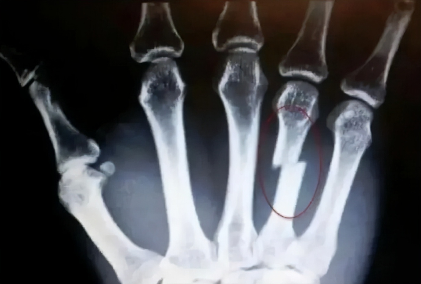 今日段子｜薇娅和李佳琦一天卖了多少钱？