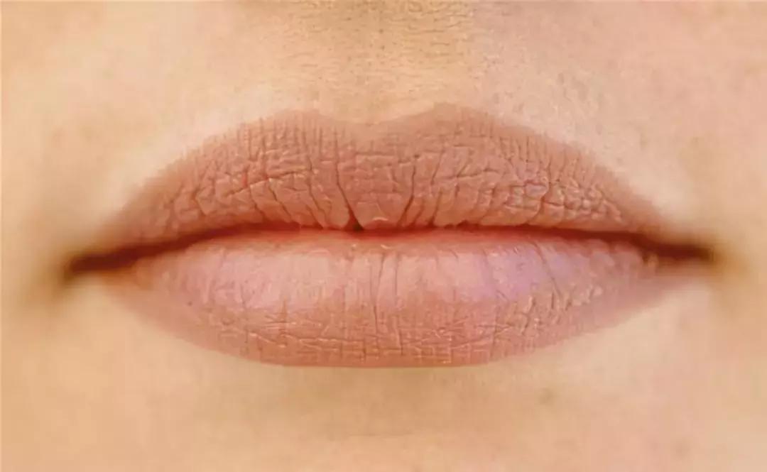 唇纹深显老吗,唇纹深好不好