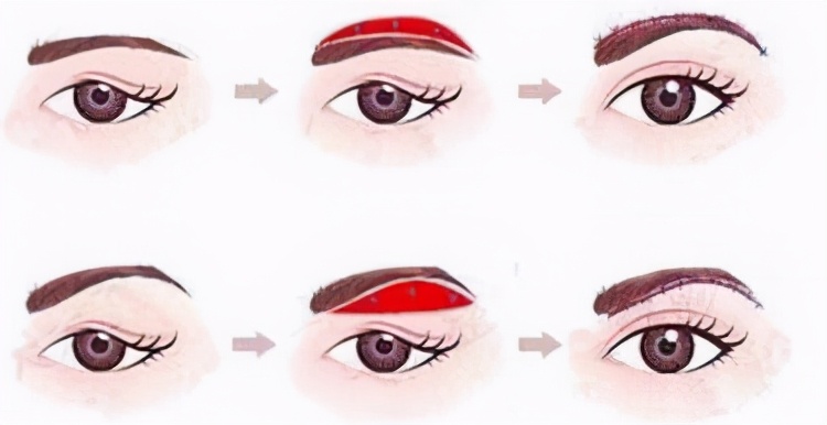 上眼皮松弛吃什么药,护肤上眼皮松弛直播