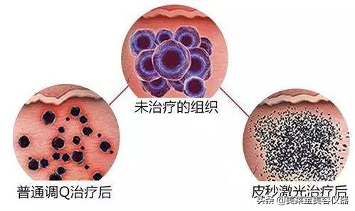 c8祛斑仪器品牌,美容仪c8和皮秒哪个好