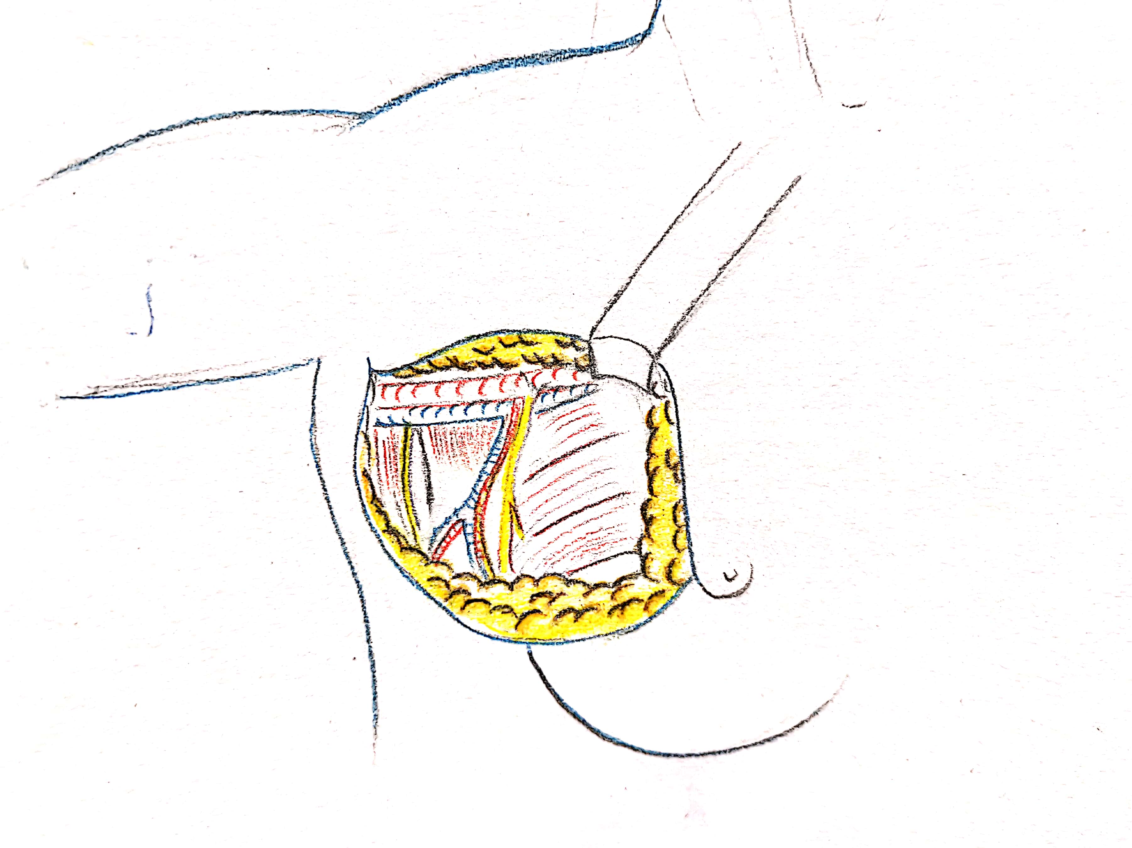 得了乳腺癌为什么不让来月经,得了乳腺癌为什么不愿切乳房
