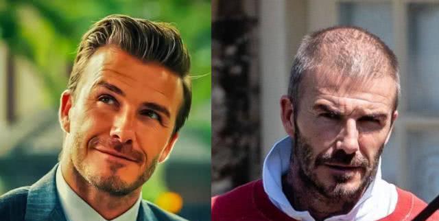 很秃却很帅的男明星,秃头但是很帅的男网红