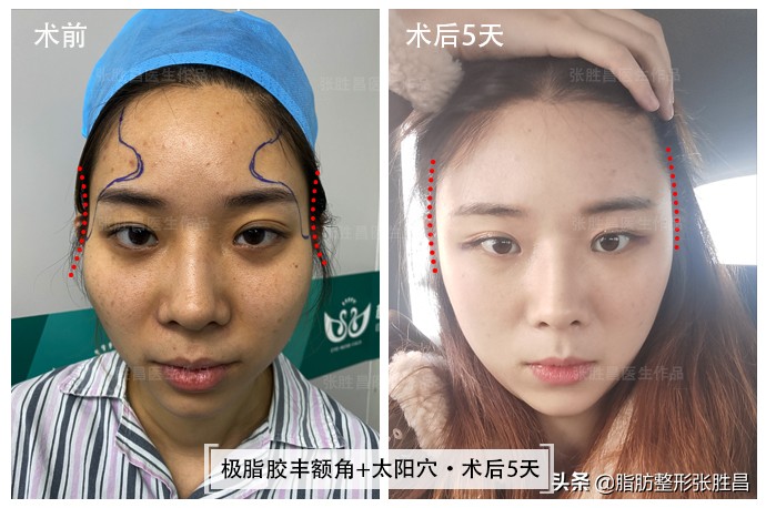 颧骨突出脸型长不好看,脸比较凶如何修饰