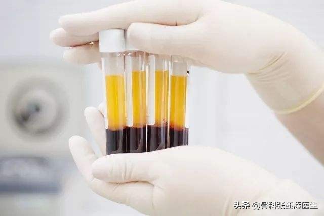 治疗膝关节痛的特效药氨糖,膝关节疼痛特效药偏方视频