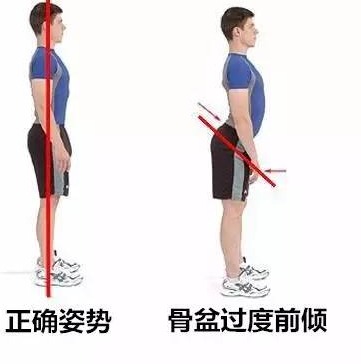 溜肩，长得再瘦体型也垮垮的。但溜肩常见这两种情况，别练错