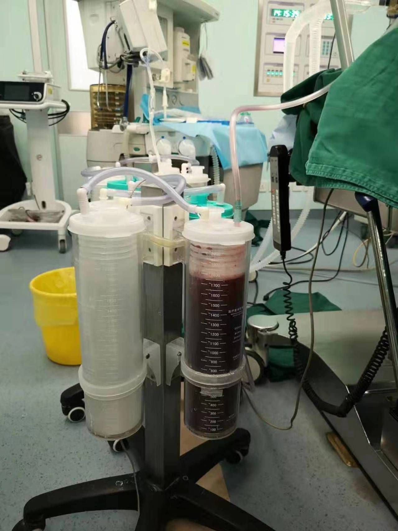 花季少女总喊肚子疼，检查竟是阴道闭锁，经血无法排出！父母自责：是我们的责任