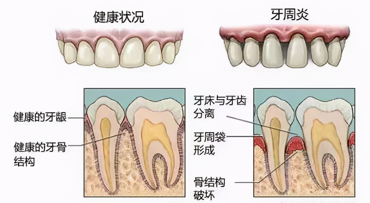 年纪轻轻的掉牙齿是怎么回事,年纪轻轻牙齿掉了