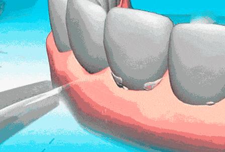 金池口腔温江,金池牙科