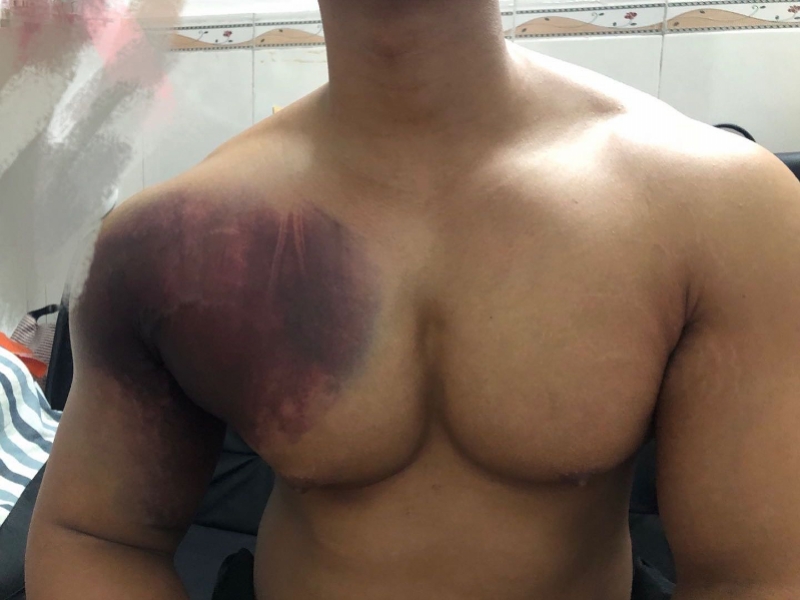 健身教练举杠铃被压伤,健身教练卧举380斤失败