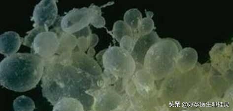 葡萄胎后一年半会怀上葡萄胎么,葡萄胎后还会怀上葡萄胎吗