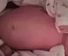 宝宝出生后的常见的一些问题