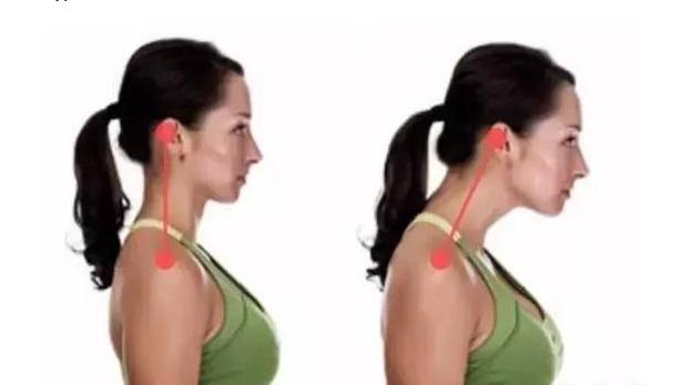 脖子上长富贵包其实是患了颈椎病,脖子后面的富贵包什么方法能去掉