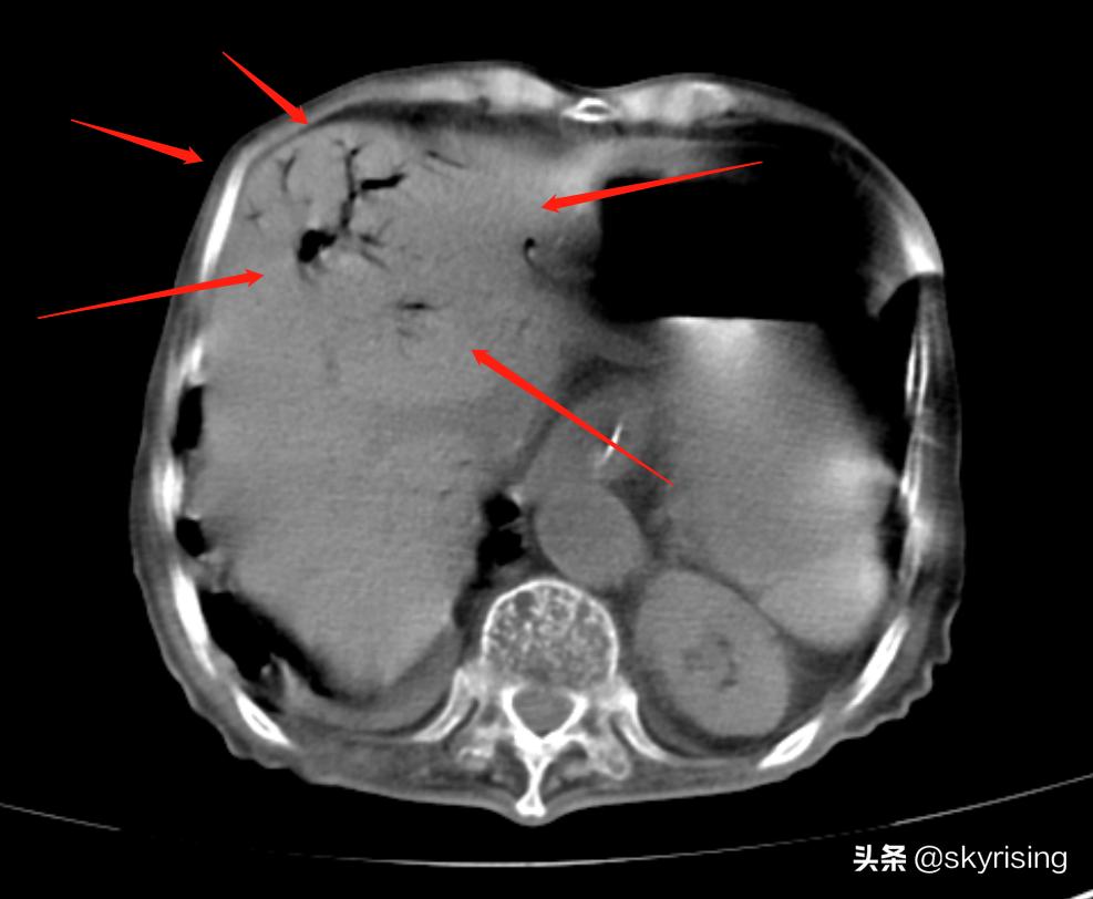老人术后并发症,老年人术后风险有哪些