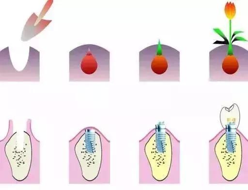 磨牙缺失不补的危害,牙齿缺失不补会导致什么后果动画