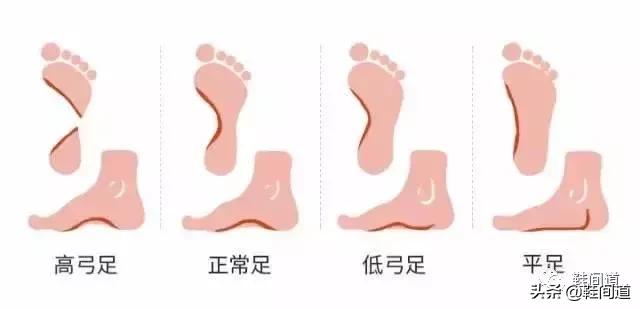 足弓对人体的影响｜脚型对鞋子的要求（附：选购建议）