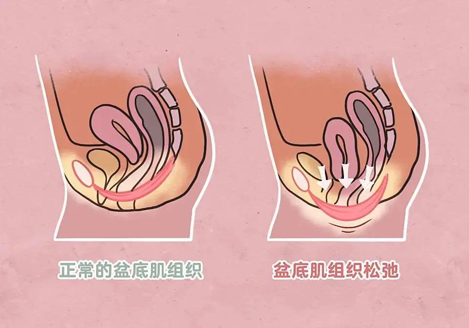 嘘！你的盆底肌居然有这么多悄悄话跟你说