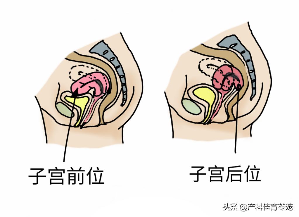 妇科b超检查正常需要做tct吗,妇科b超正常还要做阴镜吗