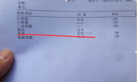 霉菌性阴道炎有什么症状能自愈吗,霉菌性阴道炎的症状怎么根治