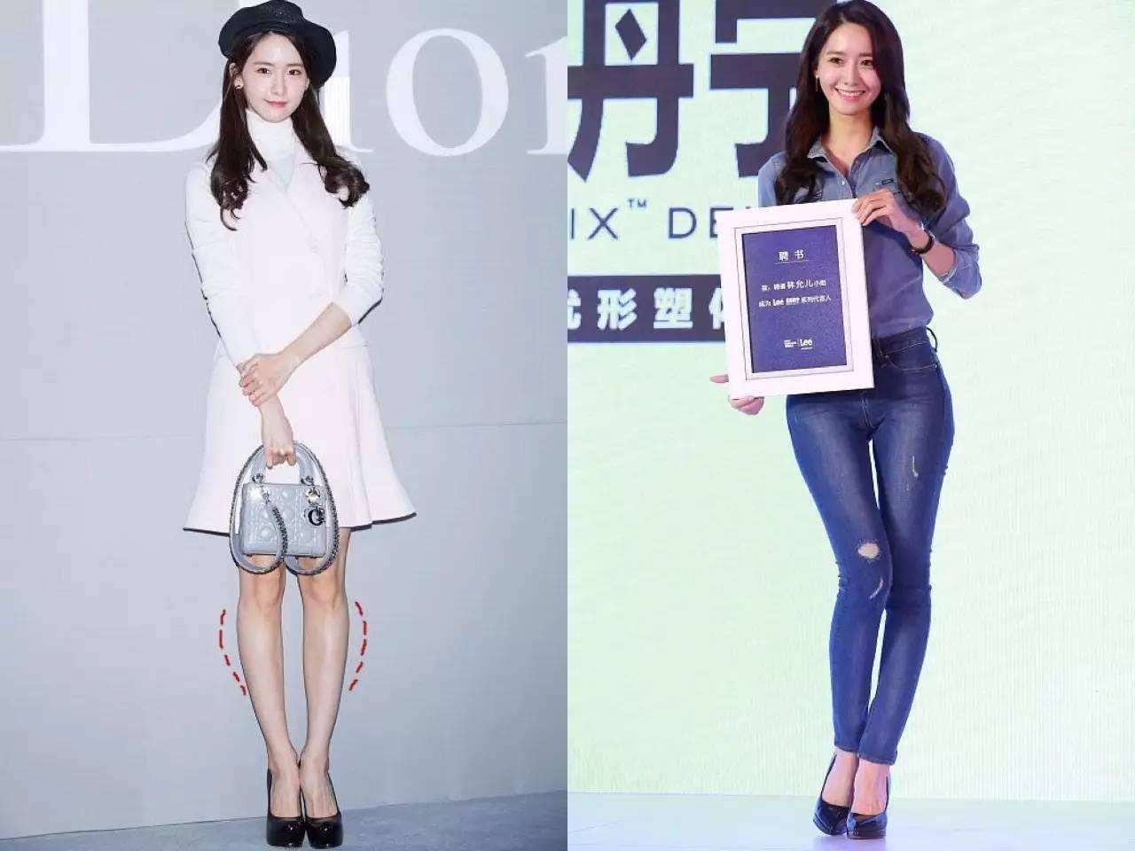 o型腿穿什么矫正好看,o型腿的穿搭方法