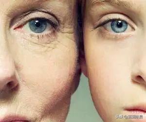 怎么改善熬夜的黑眼圈和眼角细纹,干眼症导致的黑眼圈怎样去除