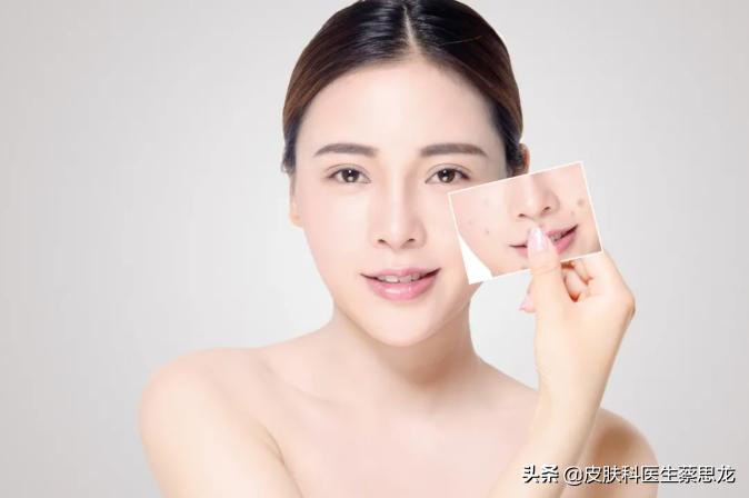 深度剖析换肤果酸刷酸到底是什么,果酸换肤的注意事项和详细步骤