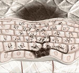 淡斑要先去除肌肤炎症吗,淡斑要做几次能彻底